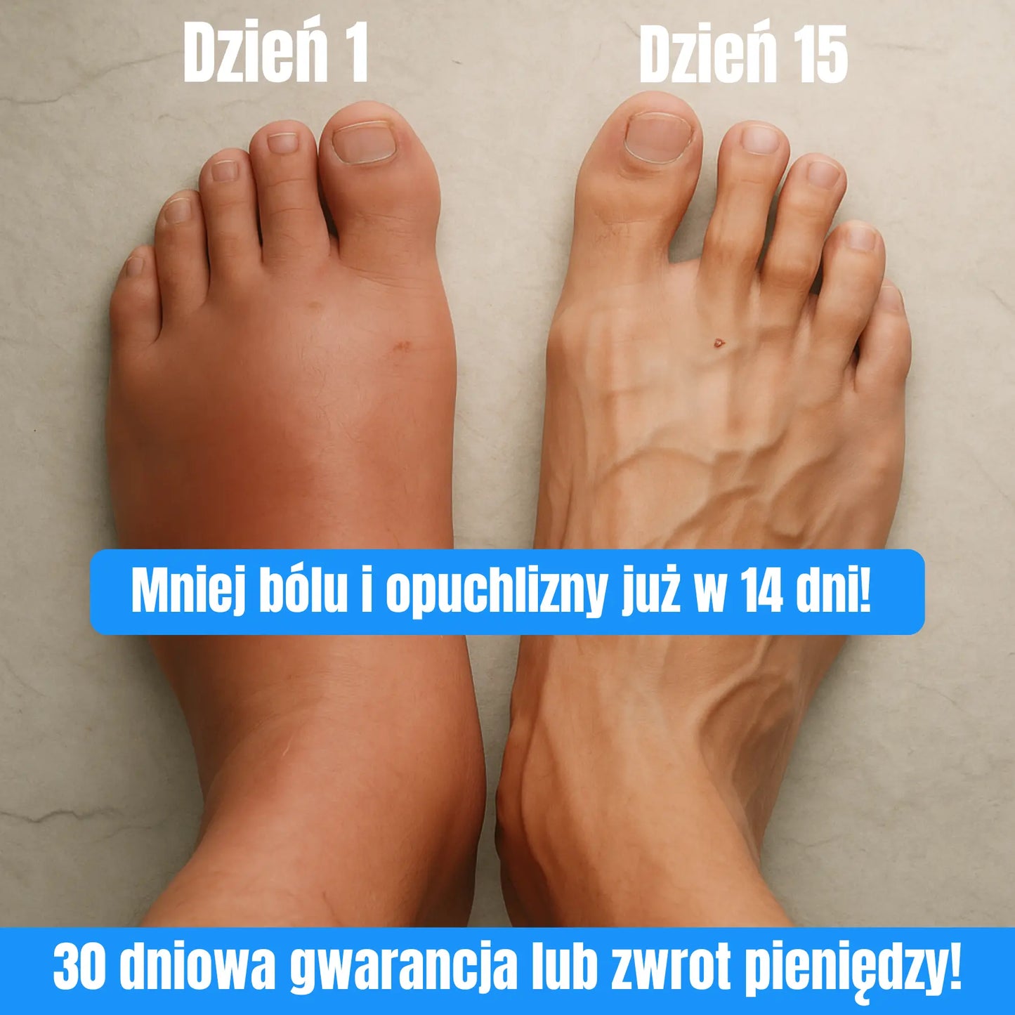 Lightlegs - Skarpetki kompresyjne dla ulgi i lekkości Twoich nóg