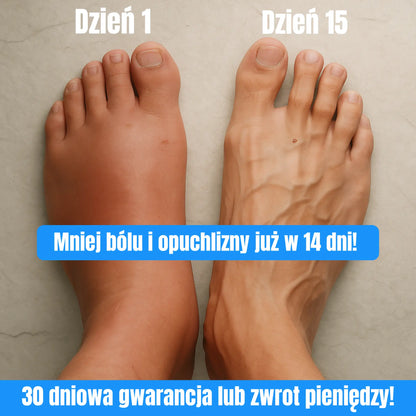 Lightlegs - Skarpetki kompresyjne dla ulgi i lekkości Twoich nóg